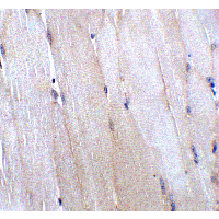 CHADL Antibody