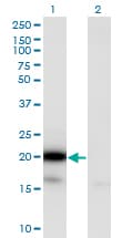 Monoclonal Mouse anti-Human UBE2G2 Antibody (clone 5E1, IHC, WB)