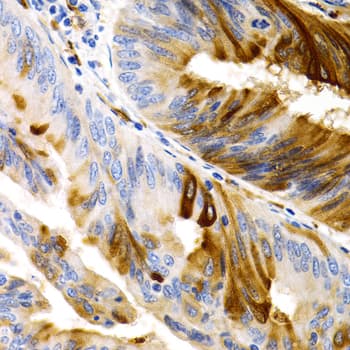 TFF1 / pS2 Antibody