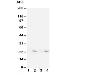 Polyclonal Rabbit anti-Human HMGB4 Antibody (aa24-41, WB)