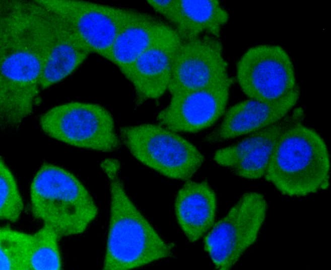 PRKCA / PKC-Alpha Antibody