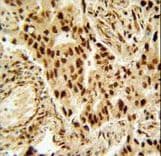 Polyclonal Rabbit anti-Human HDAC2 Antibody (aa410-439, IHC, IF, WB)