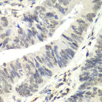 Polyclonal Rabbit anti-Human RAD17 Antibody (IHC, IF, WB)