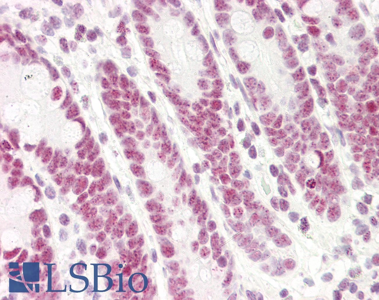 IHC-plus™ KLF4 Antibody (aa1-170, clone AT4E6)
