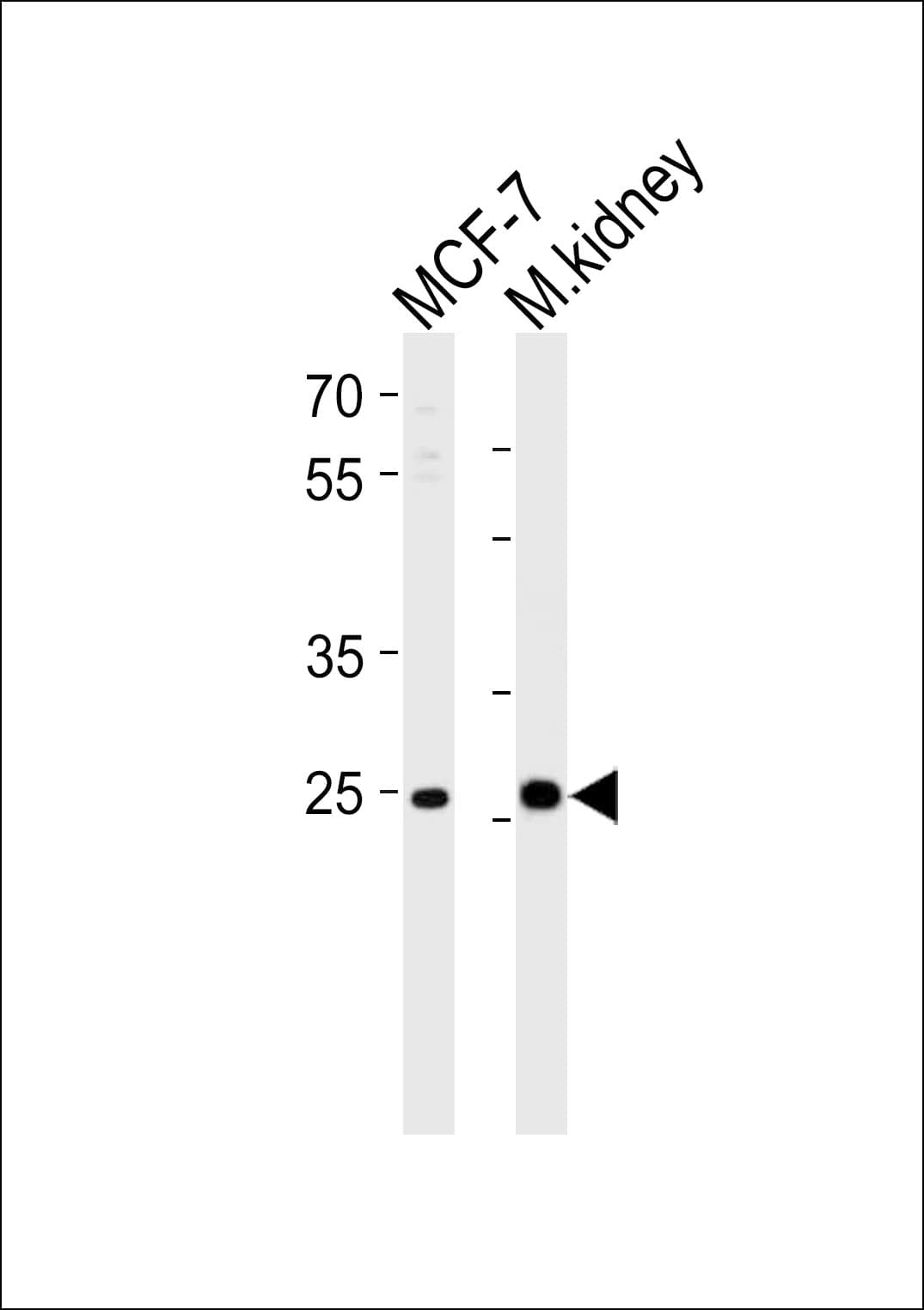 CA2 / Carbonic Anhydrase II Antibody (aa54-83)