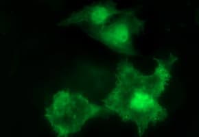 UPRT Antibody (clone OTI2F2)