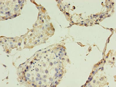 Polyclonal Rabbit anti-Human CLDN15 / Claudin 15 Antibody (aa 72-128, IHC)