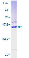 Human SSR4 Protein (Recombinant GST)