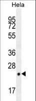CPSF4L Antibody (aa150-178)
