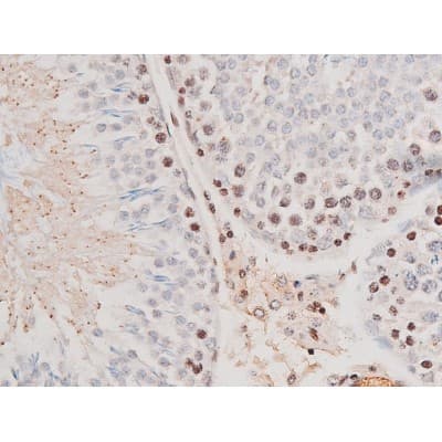 STAT3 Antibody (phospho-Tyr705)