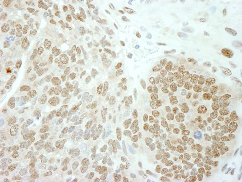 Polyclonal Rabbit anti-Human POLE3 / DNA Polymerase Epsilon Antibody (aa97-147, IHC)