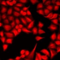 DYRK2 Antibody
