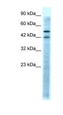 HTR3A / 5-HT3A Receptor Antibody (N-Terminus)