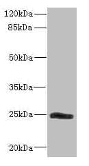 Polyclonal Rabbit anti-Human SNRPB2 Antibody (WB)