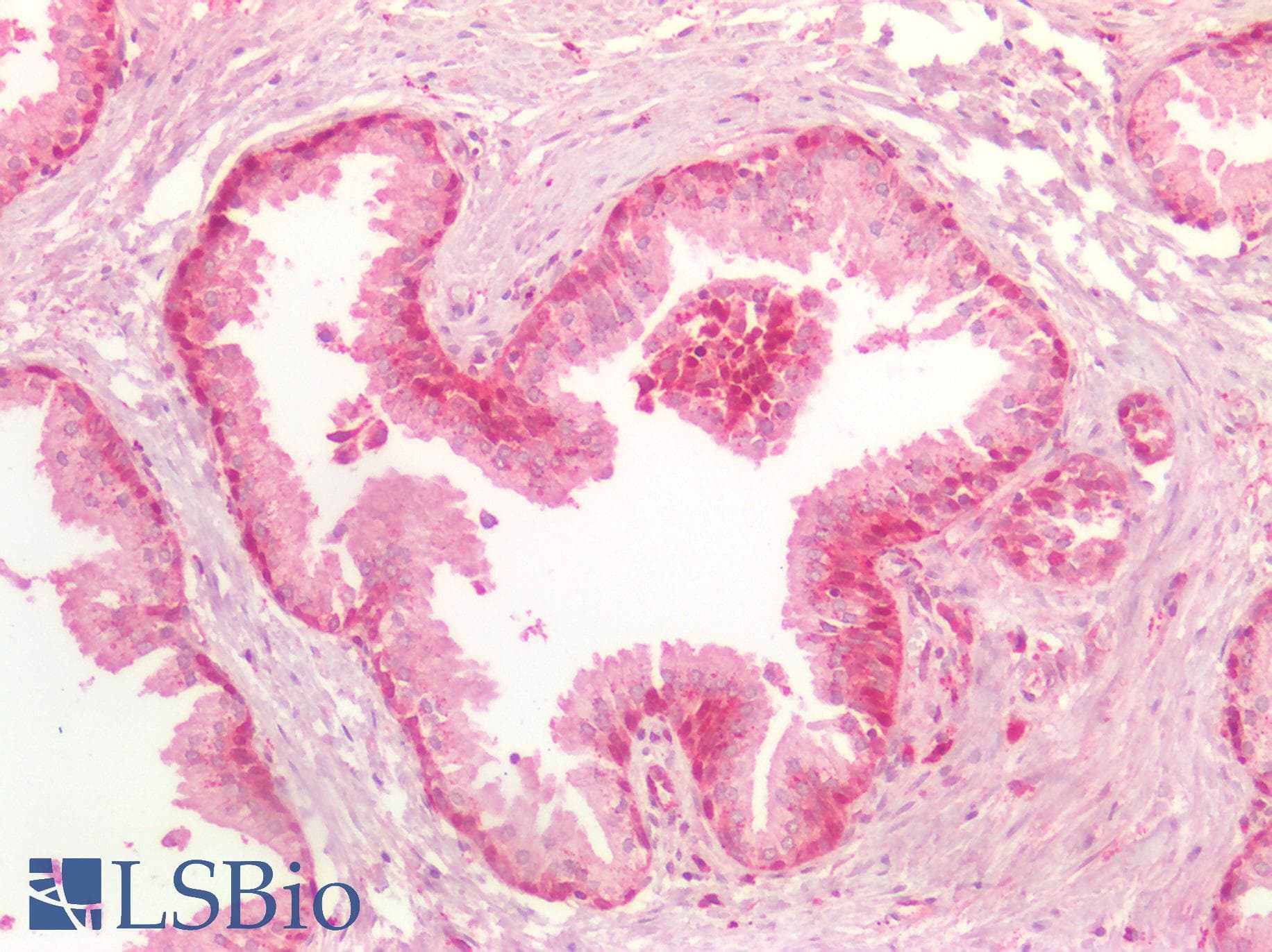 PathPlus™ Polyclonal Rabbit anti-Human AXIN2 / Axin 2 Antibody (IHC, IF, WB)