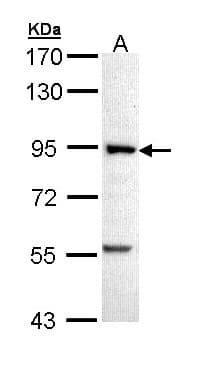 IHC-plus™ Polyclonal Rabbit anti-Human PFKM / PFK-1 Antibody (aa1-253, IHC, WB)