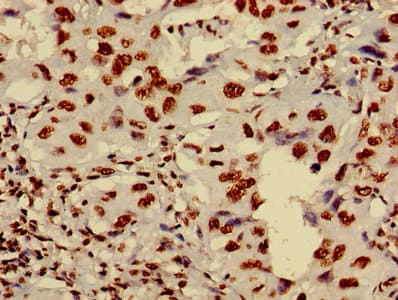 HIST1H4I Antibody