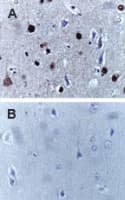 CASP9 / Caspase 9 Antibody