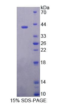 Mouse ERP44 Protein (Recombinant His-T7, N-terminus)