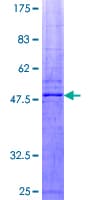 Human SOCS2 Protein (Recombinant GST)