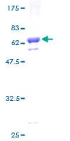 Human PDXK / PNK Protein (Recombinant GST)
