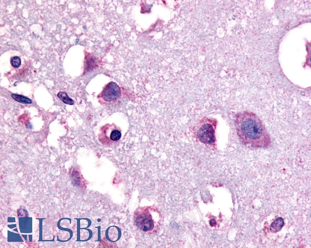 PathPlus™ CRFR1 / CRHR1 Antibody (N-Terminus)