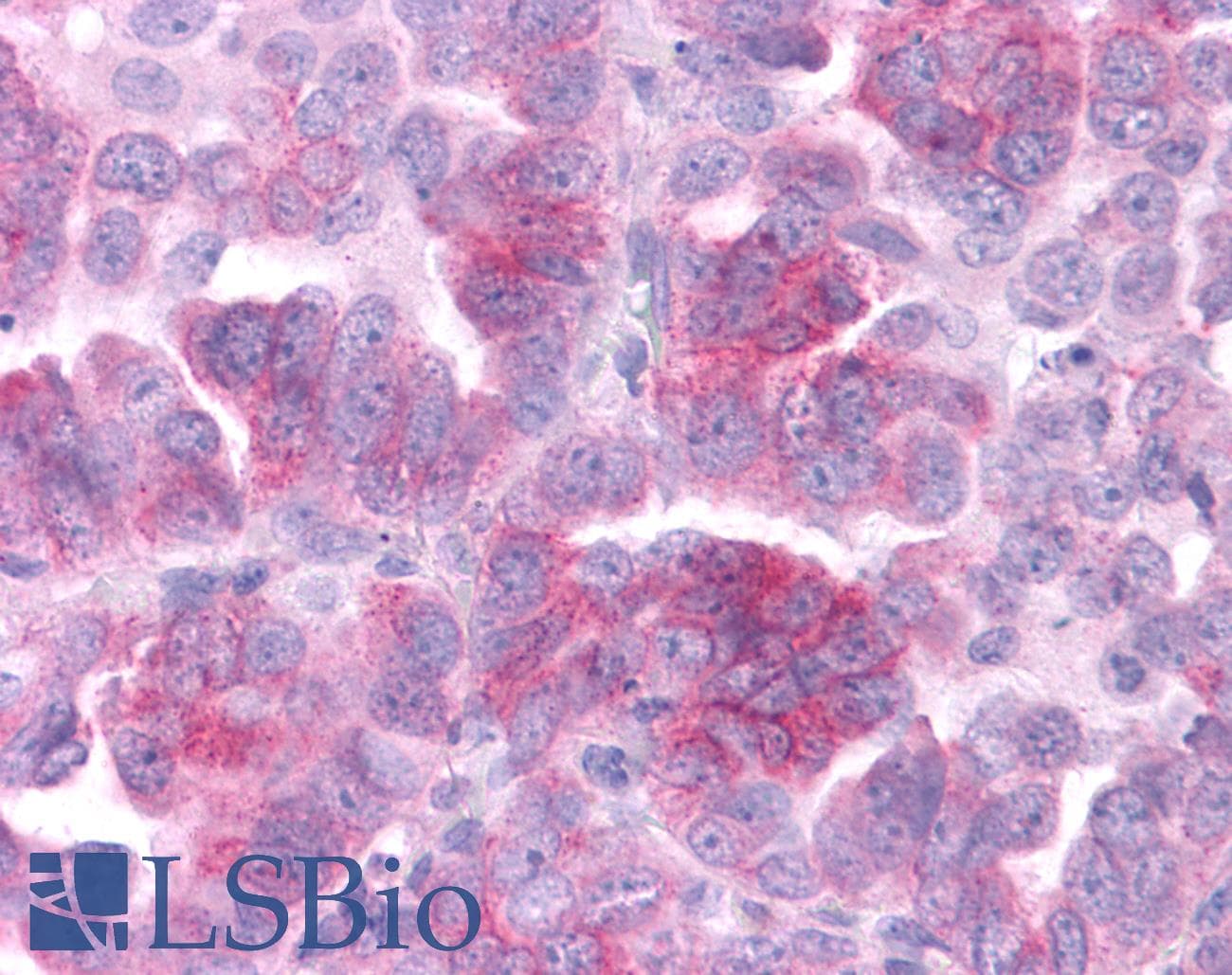 IHC-plus™ DUSP23 Antibody (Internal)