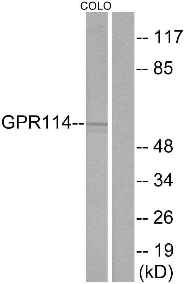 Polyclonal Rabbit anti-Human ADGRG5 /GPR114 Antibody (WB)