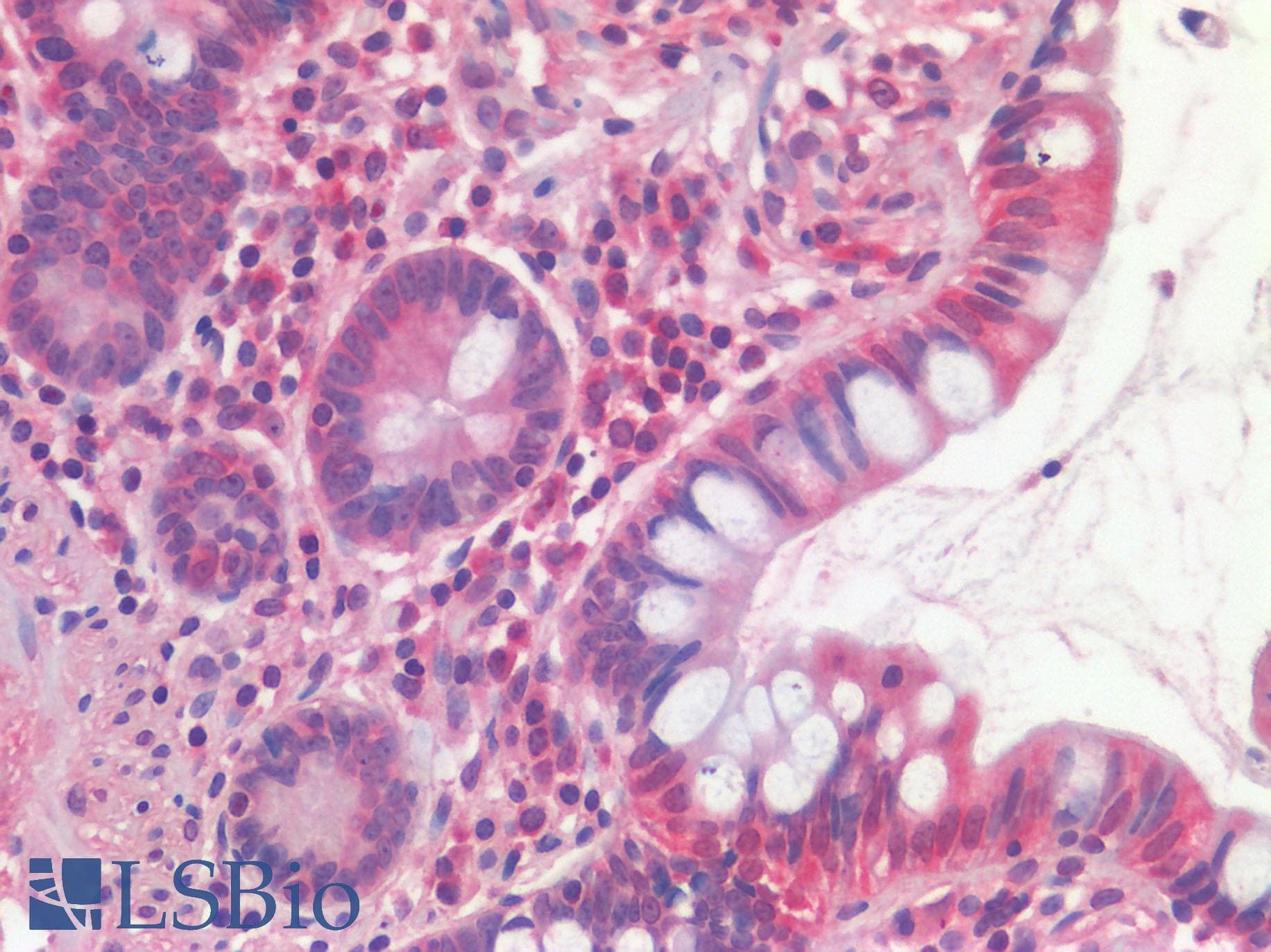 IHC-plus™ SLC40A1 / Ferroportin-1 Antibody (N-Terminus)