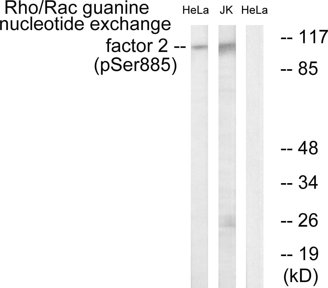 Polyclonal Rabbit anti-Human ARHGEF2 / GEF-H1 Antibody (phospho-Ser885, WB)