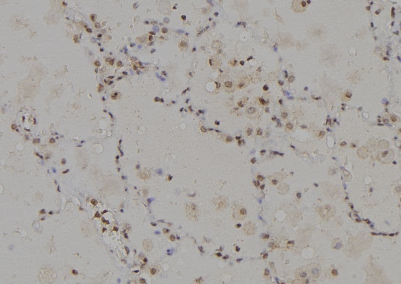 CAGE1 / Cancer Antigen 1 Antibody