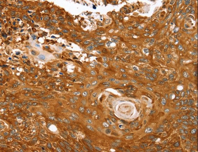 ABCC8 / SUR1 Antibody