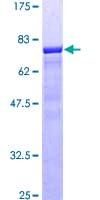Human SEPT9 / Septin 9 Protein (Recombinant GST)