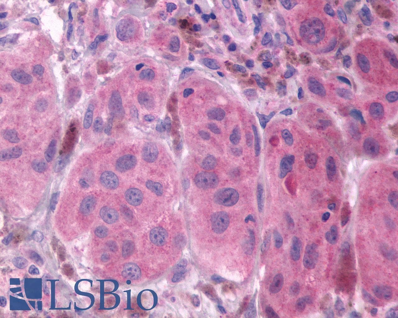 PathPlus™ FP / PTGFR Antibody (Extracellular Domain)