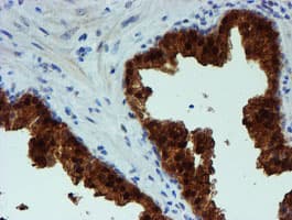 PGM3 Antibody (clone OTI1A11)