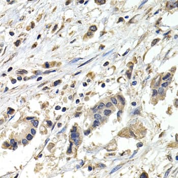 Polyclonal Rabbit anti-Human BUB1B / BubR1 Antibody (IHC, WB)