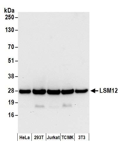 LSM12 Antibody (aa145-195)
