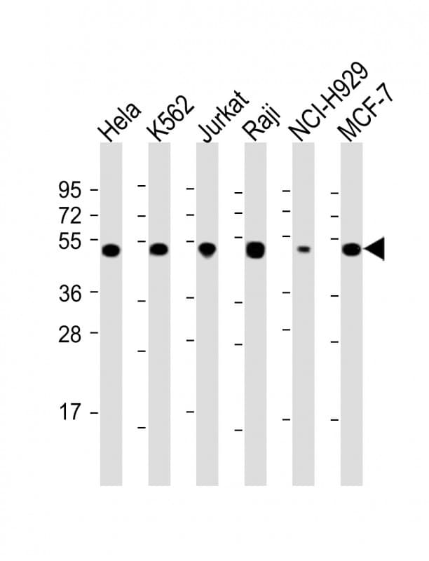 RPL4 / Ribosomal Protein L4 Antibody (N-Terminus)