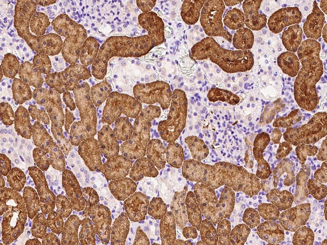 Polyclonal Rabbit anti-Human ARF3 Antibody (IHC)
