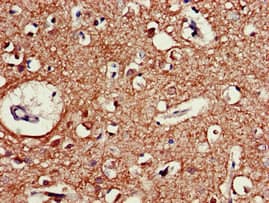 CHRM5 / M5 Antibody