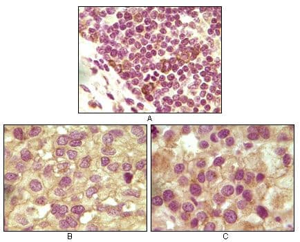 INHA / Inhibin Alpha Antibody (clone 4A2)