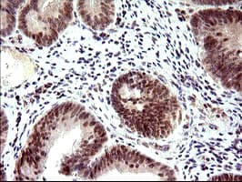 PMS2 Antibody (clone OTI2G5)