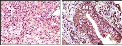 EPHB6 / EPH Receptor B6 Antibody (clone 8E7H12)