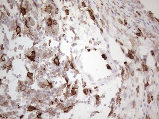 ITGAM / CD11b Antibody (clone OTI12C10)