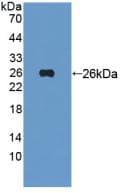 TIE1 / TIE Antibody