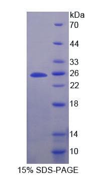 Human SCG5 / 7B2 Protein (Recombinant His-T7)