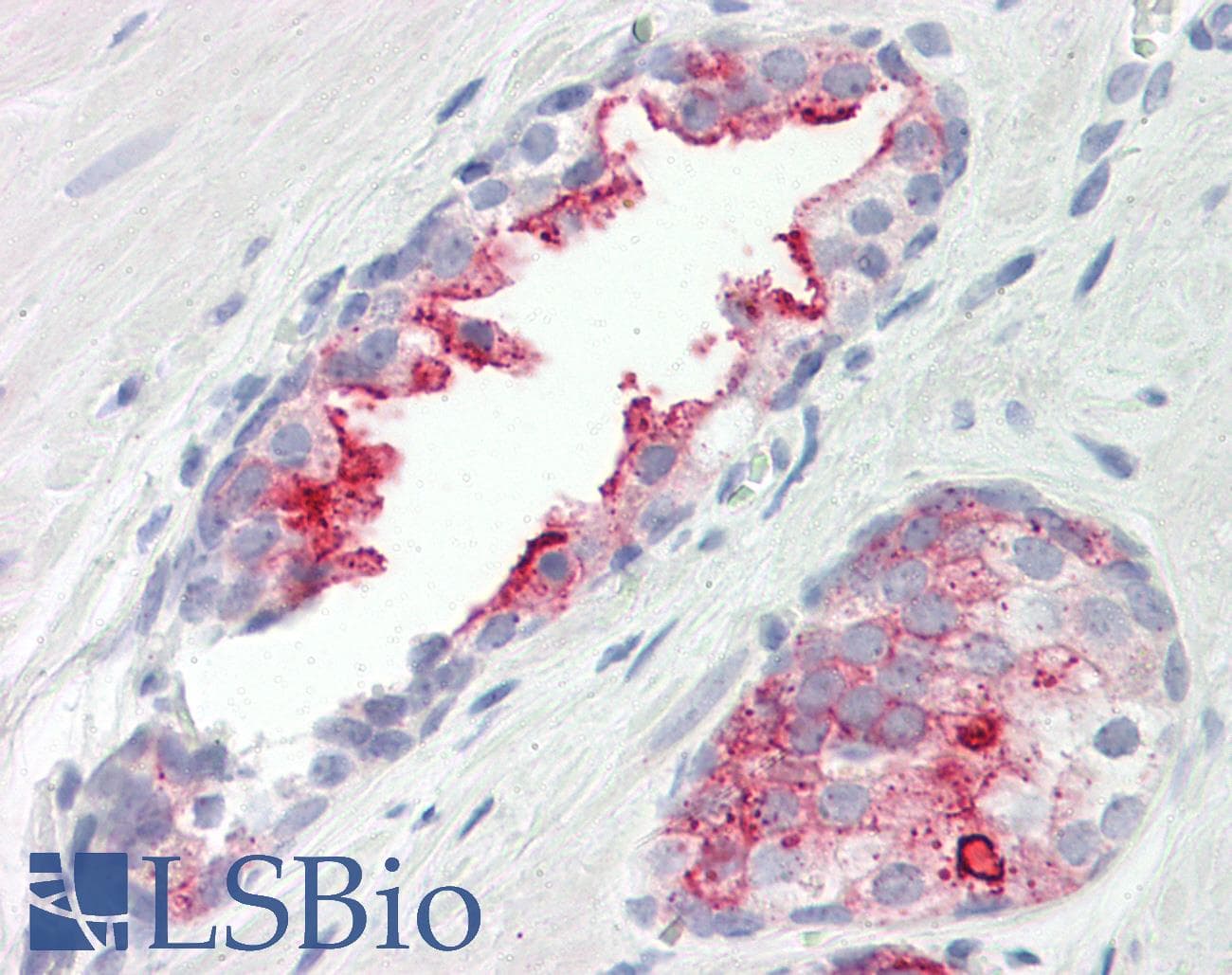 IHC-plus™ Polyclonal Rabbit anti-Human RAB41 Antibody (aa115-164, IHC)