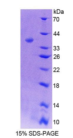 Mouse AANAT Protein (Recombinant His-T7)