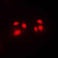 Polyclonal Rabbit anti-Human CBFB Antibody (N-Terminus, IHC, IF, WB)