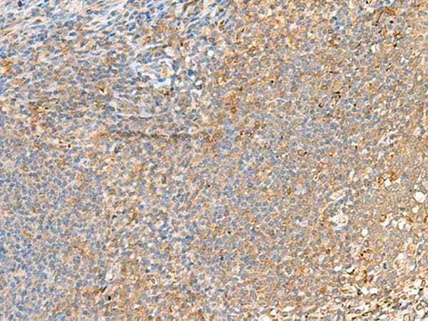 GRIK2 / GLUR6 Antibody